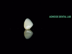 セラミック・クラウン・ブリッジ