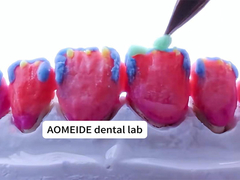 耐久性 自然 エステティック 固体 ジルコニア 冠 単歯や複数歯にぴったり