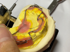 オーダーメイド 矯正歯科器具 収納能力が良し 調整可能な機能