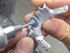 鋳造された部分歯入れ