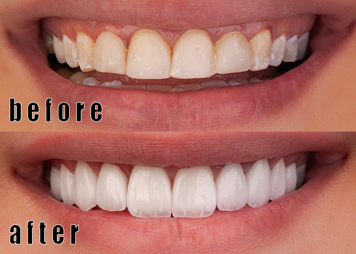 企業に関する最新事例 エマックス・ファニアケース 1