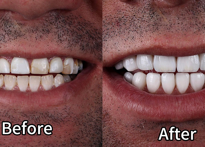 企業に関する最新事例 エマックス・ファニヤケース2