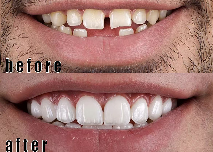 企業に関する最新事例 ポルセラン・フェニールケース 3