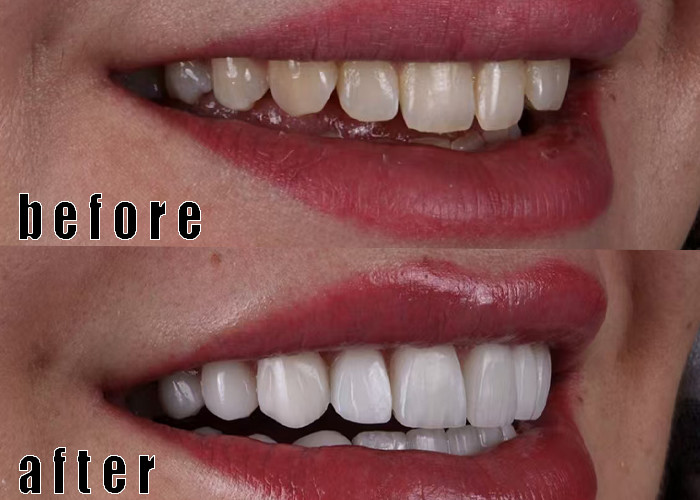 企業に関する最新事例 グラスセラミック・ファニヤケース 4