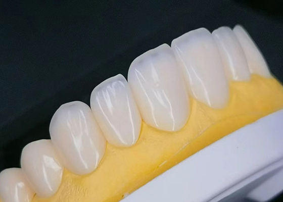 購入 自然な外観の美学復元のために汚れ耐性のあるEMAXポルセランフェニヤー online manufacture