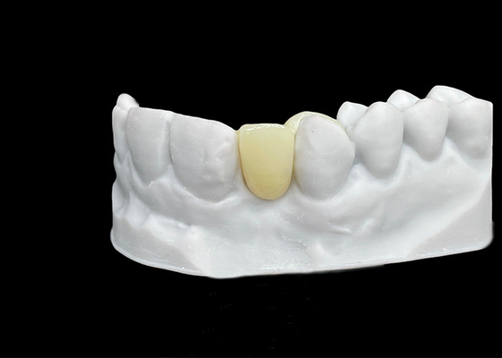 購入 破裂 耐久 性 抜群 な 強さ と 透き通し 性 を 備える ジルコニア 歯科 冠 online manufacture