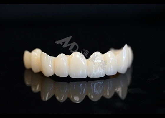 購入 精密に作られた固体ジルコニアの冠 歯のフィットと快適さのために online manufacture