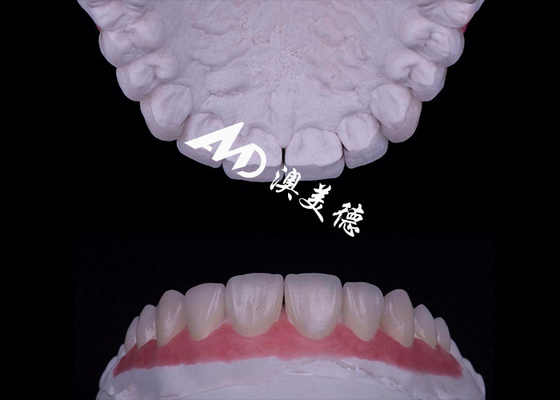 購入 透明性 EMAX ポルセラン フェニエール 汚れ耐性/強度 online manufacture