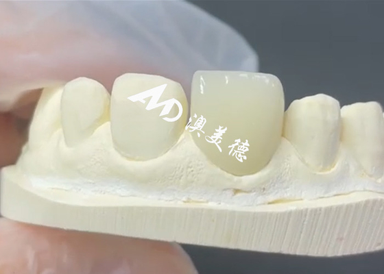 購入 耐久 し て 美しい エマックス プラネール 陶器 修復 の 完璧な 解決策 online manufacture