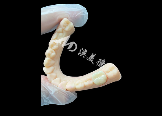 購入 高強度セラミックジルコニア 後部歯冠 優れた美学と耐久性 online manufacture