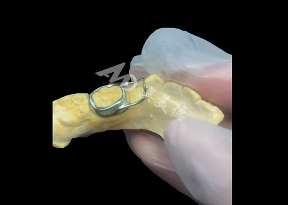 購入 歯科スペースメンテナー 宝くじな装置で 巧妙に歯の隙間を保ち 歯の正常な発達を保証します online manufacture