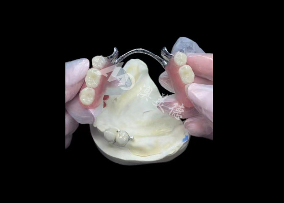 購入 耐久性ポルセラン メタルに溶かされた歯科冠 PFM 回復のための冠 online manufacture