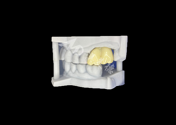 購入 固体ジルコニア 歯科冠 耐久性保証 歯科ラボから online manufacture