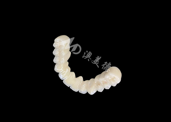 購入 耐久性のある結合 優れた生物互換性のあるPFM歯科冠橋 安全な結合 online manufacture