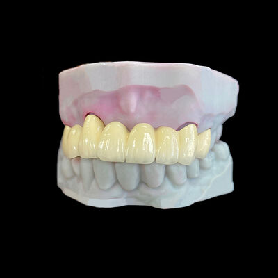 購入 コ-Cr フレーム付きの金属に溶融したポルセラン (PFM) クローネン online manufacture