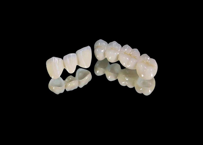 耐磨性 Zirconia 歯冠 中国製歯科ラボから