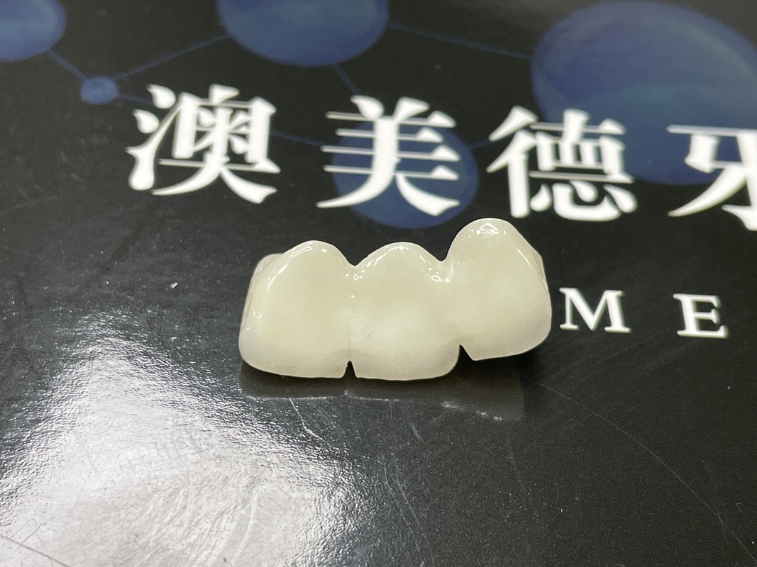 天然 美容 歯を修復するための透明性セラミック冠 清掃が簡単で長期にわたる効果