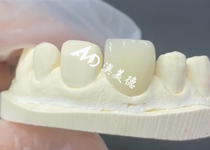耐久 し て 美しい エマックス プラネール 陶器 修復 の 完璧な 解決策