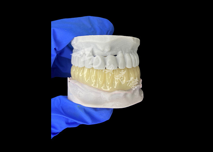 軽量 バイオコンパティブル 3Dプリント 埋め込み前修復用の空洞一時橋