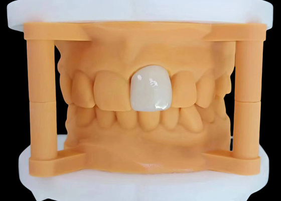良い値段 透明性 Zirconia 歯冠 華麗な性能 中国歯科ラボ オンライン