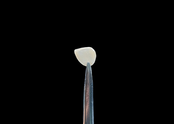 良い値段 精度 0.2-0.5mm EMAX 化粧品 歯のフロニヤ 自然な外観 化学結合 オンライン
