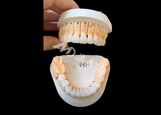 良い値段 強化された透明性 Zirconia 歯冠 単体/多ユニット固定修復 オンライン