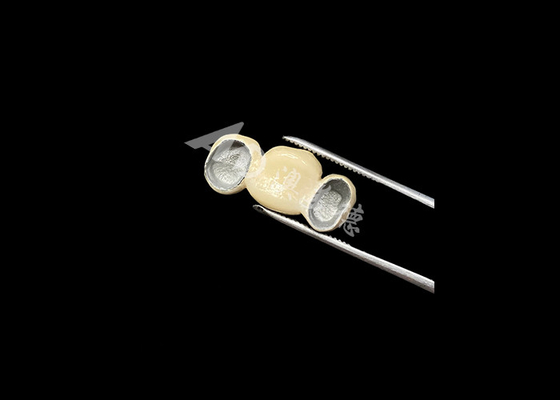 良い値段 精密にフィットしたポルセラン 優れた生物互換性を持つ金属の冠に溶融 オンライン