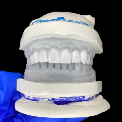 良い値段 Diagnostic Wax-Up for Porcelain Veneers オンライン