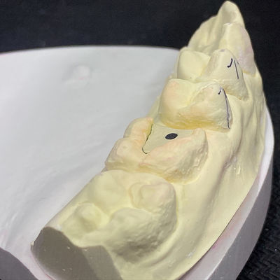 良い値段 ロックピンクポストコア技術で修復を強化 オンライン