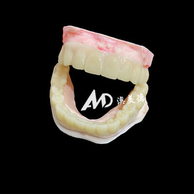 良い値段 Lightweight PMMA Temporary Bridges with Hollow Design for Implant Restorations オンライン