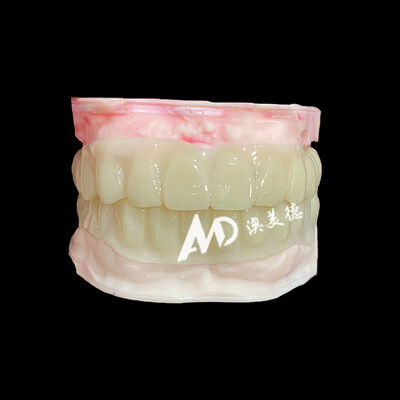 良い値段 PMMA Hollow Temporary Bridges for Implant Provisional Cases オンライン