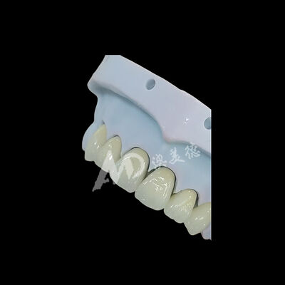良い値段 フルコンター単冠ジルコニアクラウン オンライン